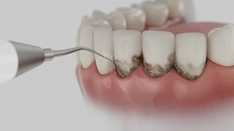 Trusted Dental Crowns And Bridges service in Glenwood, MN - Dentist Open Now